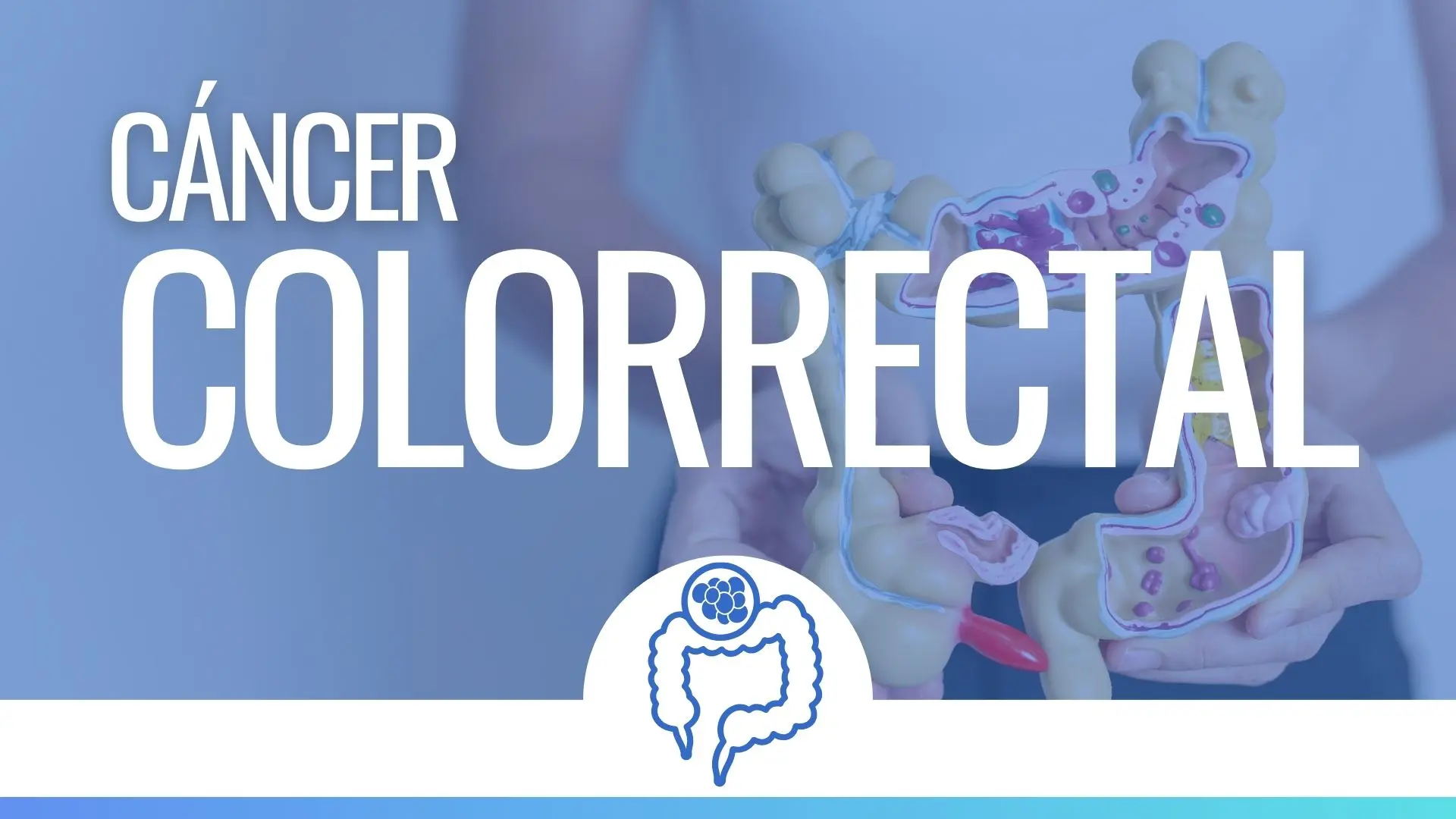 Tratamiento para Cáncer Colorrectal