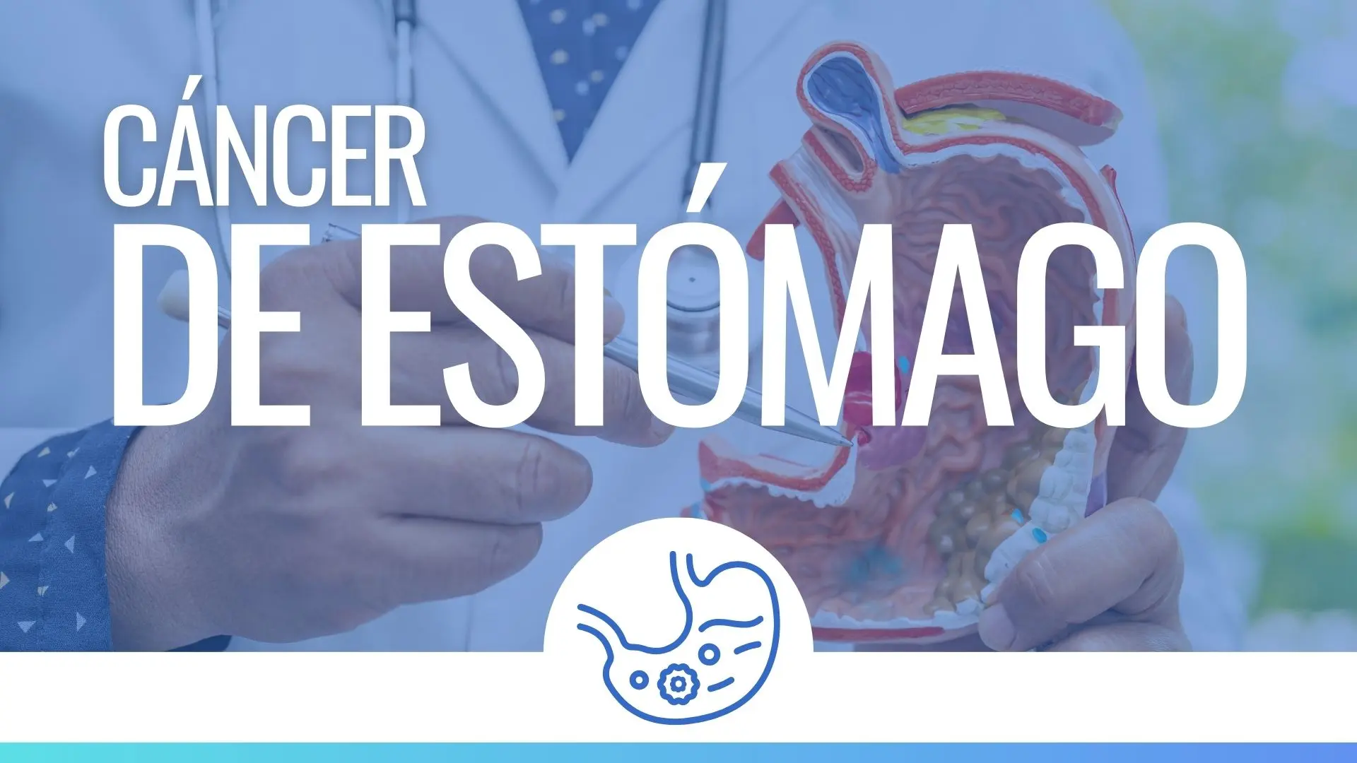 Tratamiento para Cáncer de Estomago