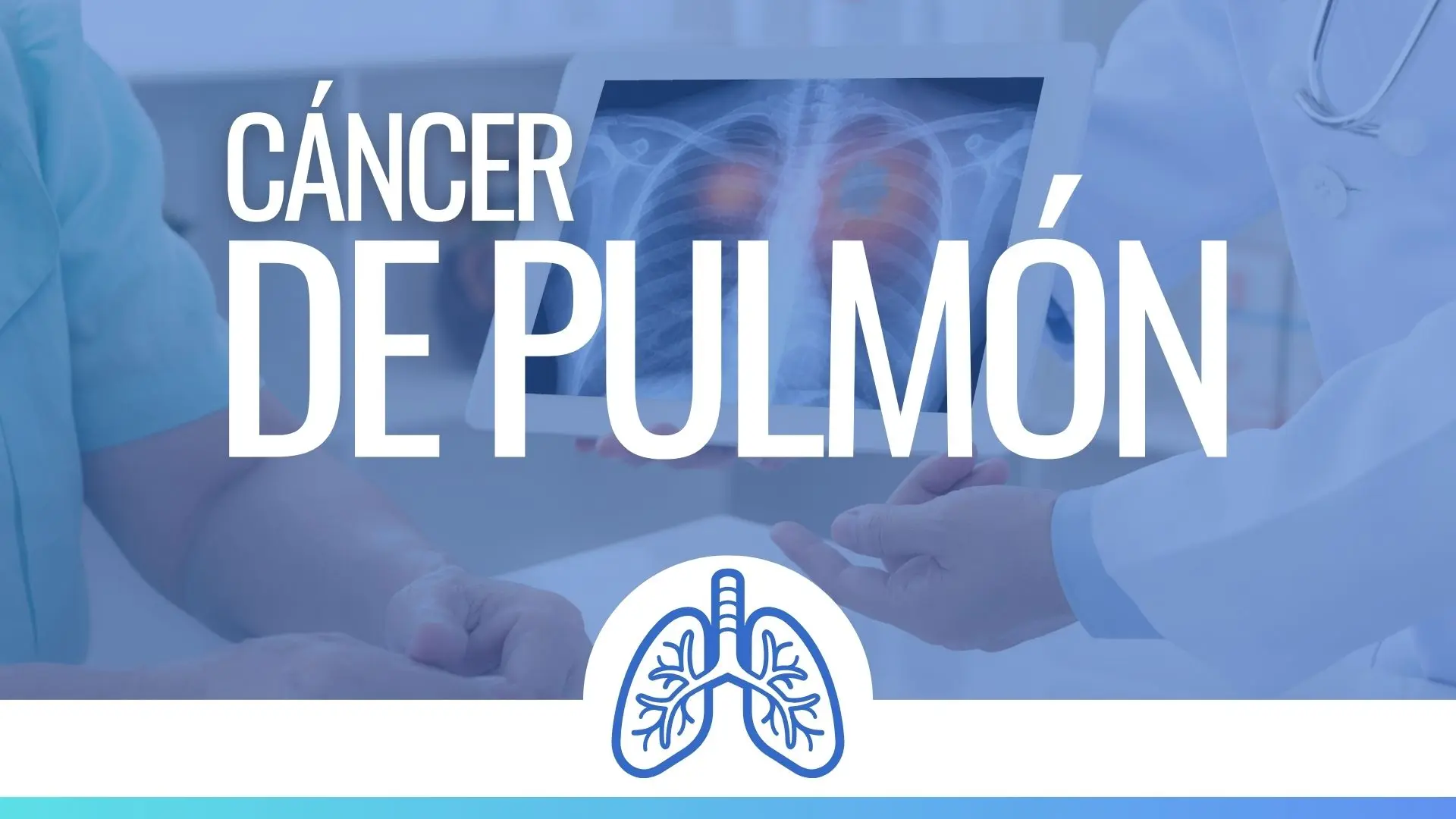 Tratamiento para Cáncer de Pulmón