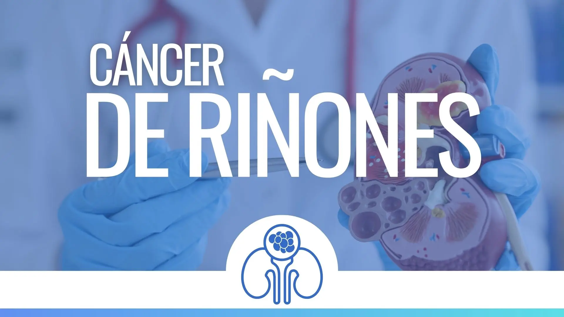 Tratamiento para Cáncer de Riñones